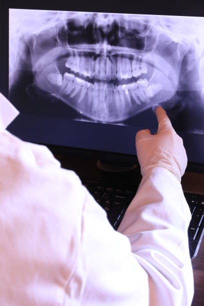 Best Emergency Treatment for Toothache in East Sonora, CA